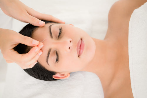 Woman in an acupuncture therapy at the health spa