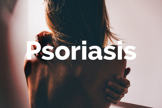 Psoriasis