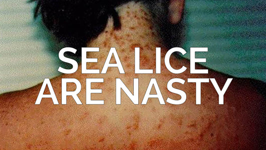Sea Lice are Nasty!